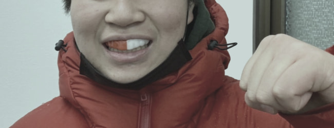 スポーツマウスピース・アバンティース